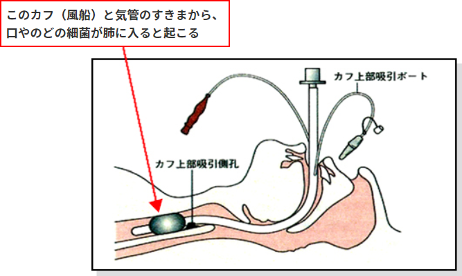 よくわかる!口腔ケア メヂカルフレンド社P108-111 2007年